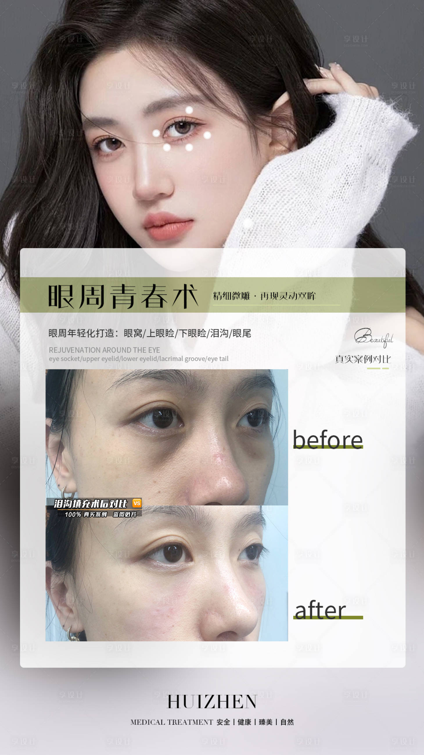 源文件下載【享設計】搜索編號：54140014743158333【醫美臉部輪廓案例簡約海報】