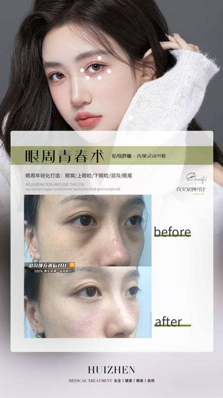 编号：20230215202808413【享设计】源文件下载-医美脸部轮廓案例简约海报