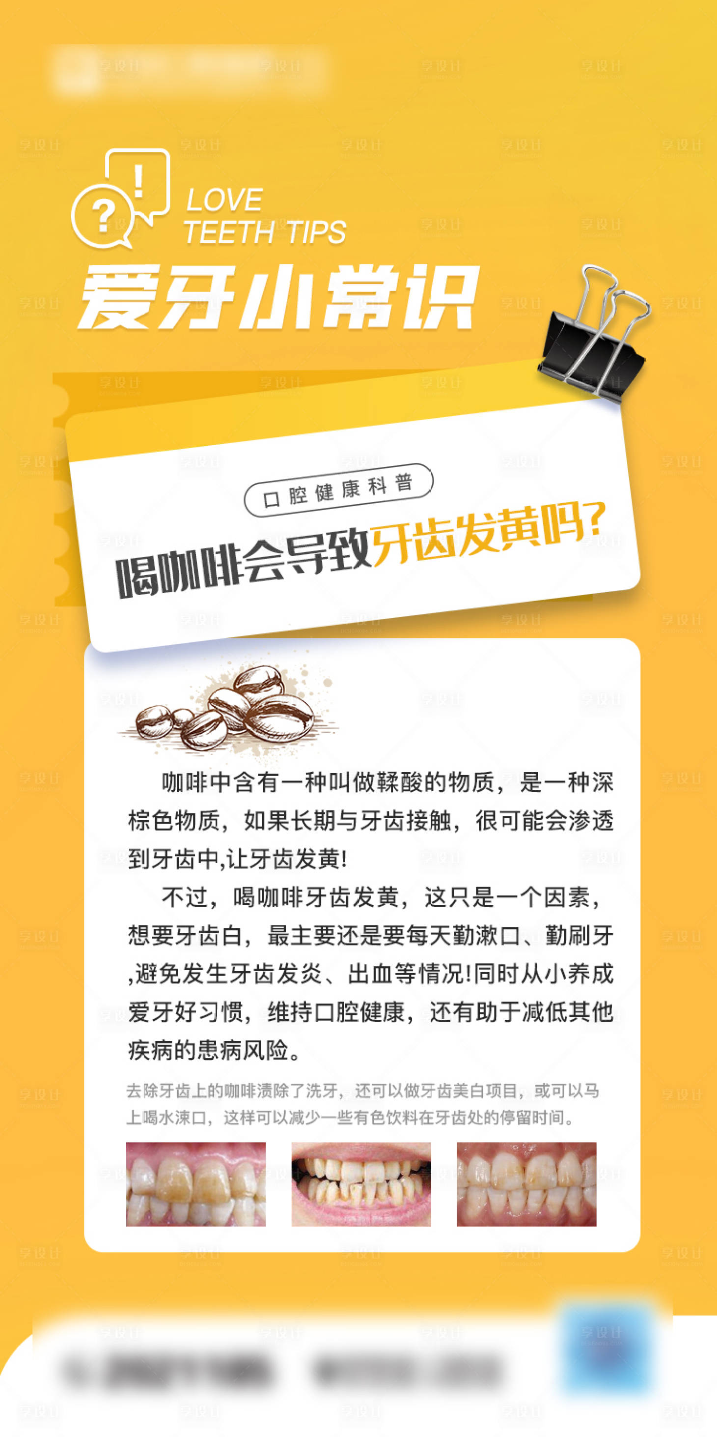源文件下载【口腔爱牙小常识海报】编号：27770014722713064