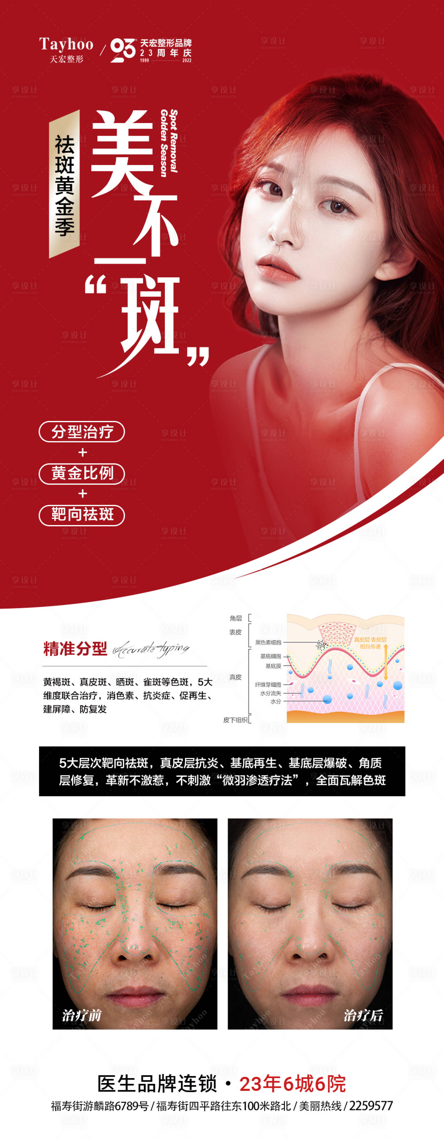 源文件下載【享設計】搜索編號：52380014505426383【醫美整形海報祛斑黃金季案例對比】