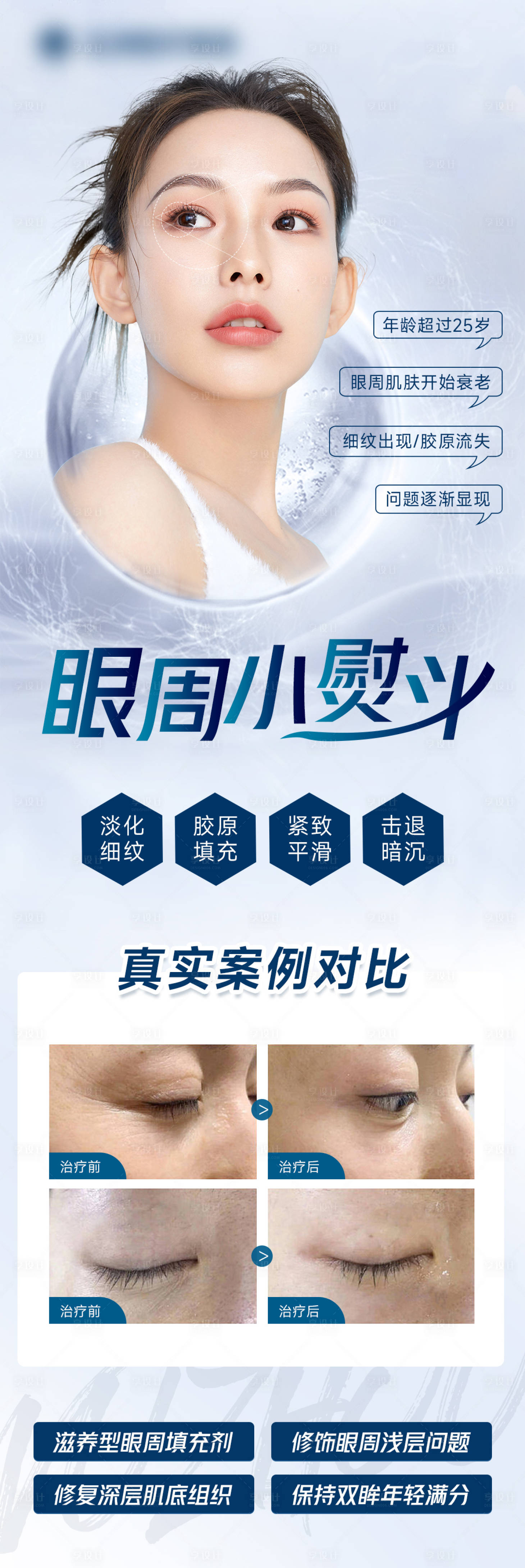 源文件下载【享设计】搜索编号：37400014562401885【眼周小熨斗海报长图】