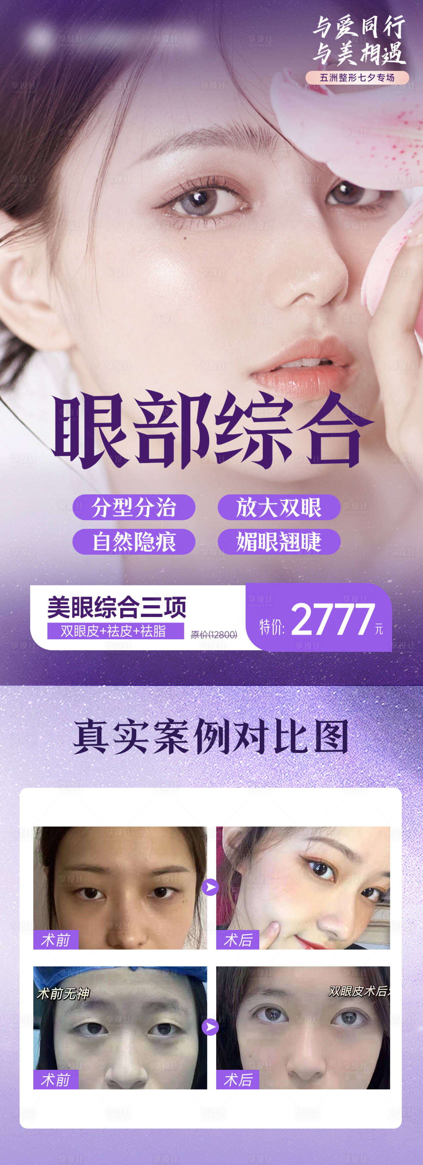 源文件下载【享设计】搜索编号：22070014561943347【眼综合海报】
