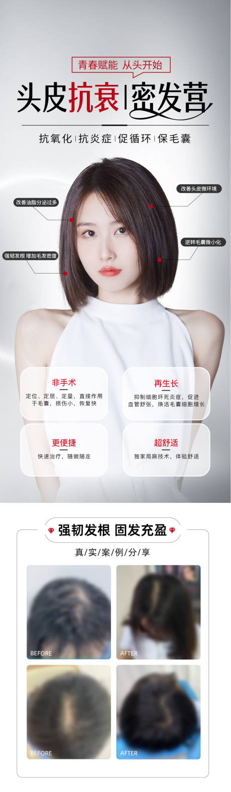 源文件下载【3d头发抗衰植发案例落地页】编号：96880015014692442