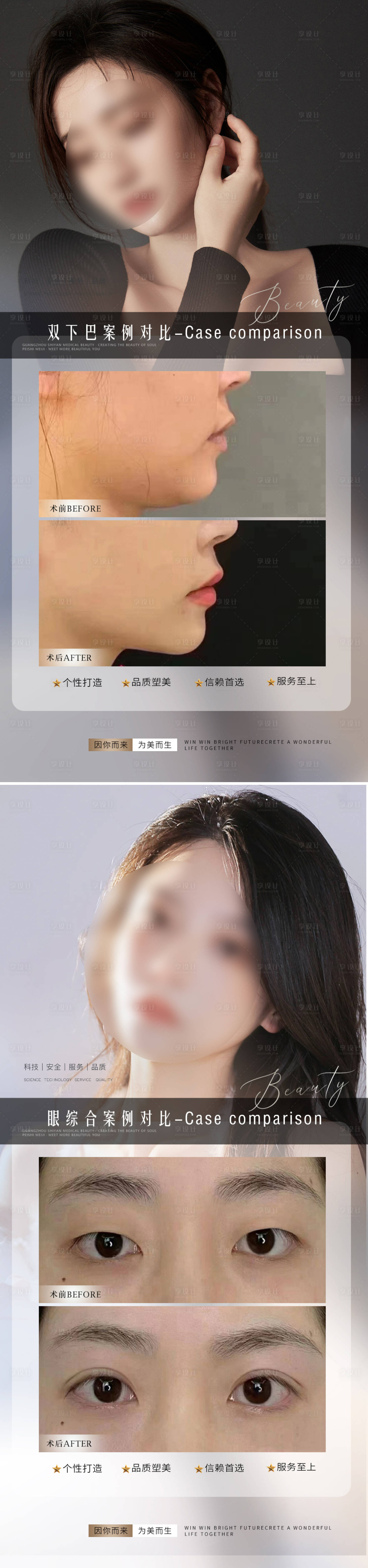 源文件下载【医美整形案例对比海报】编号：41970014661499958