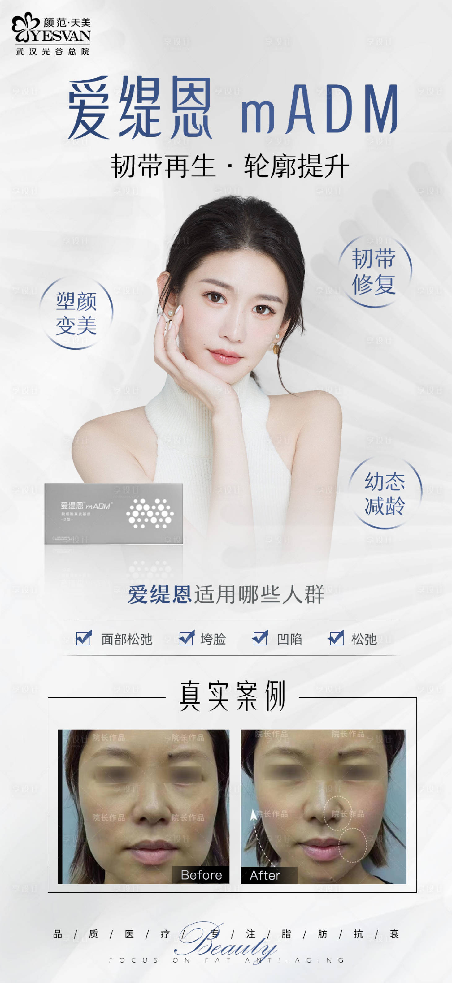 源文件下載【享設(shè)計(jì)】搜索編號(hào)：51000014654077438【愛緹恩項(xiàng)目宣傳海報(bào)】
