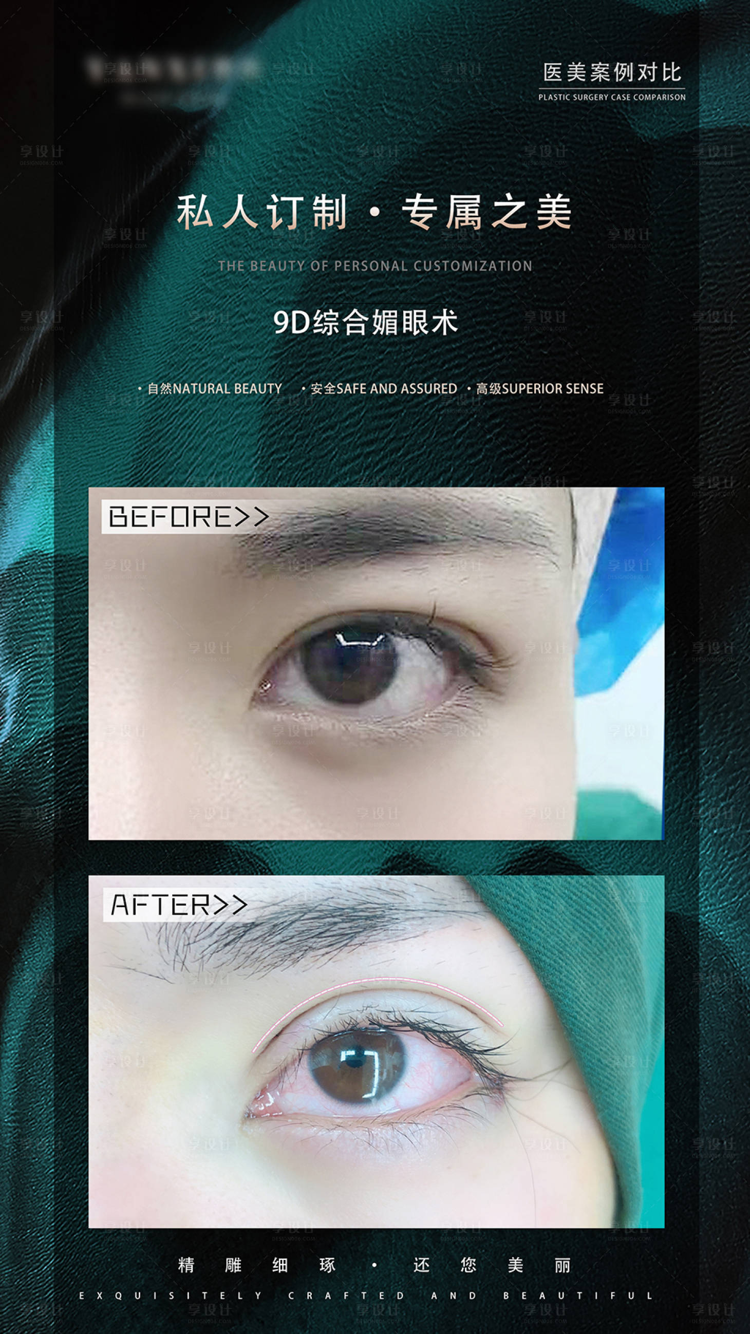 源文件下载【享设计】搜索编号：66650014651287044【眼综合案例对比绿金海报】