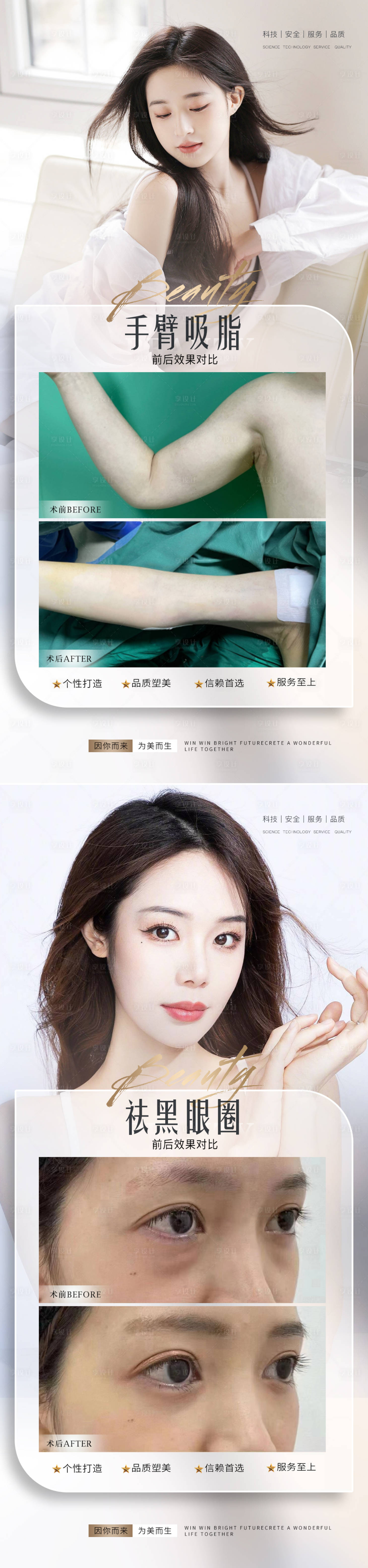 源文件下載【醫美整形真人案例海報】編號：35360014614302064