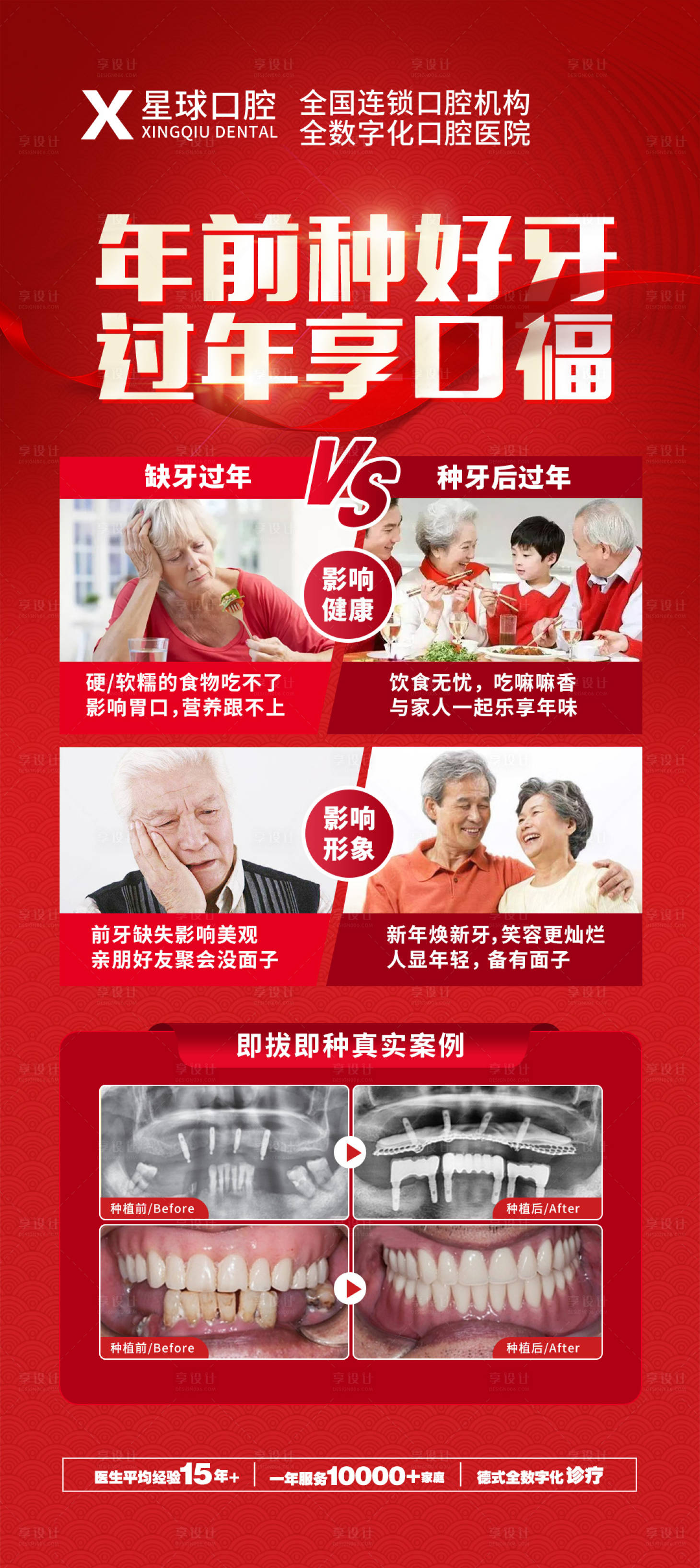 源文件下載【享設計】搜索編號：89840014667505692【種植牙活動海報】