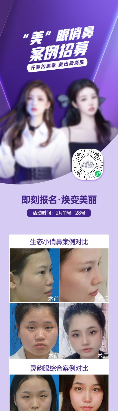 源文件下载【医美美眼俏鼻体验官案例招募】编号：20230213163802159