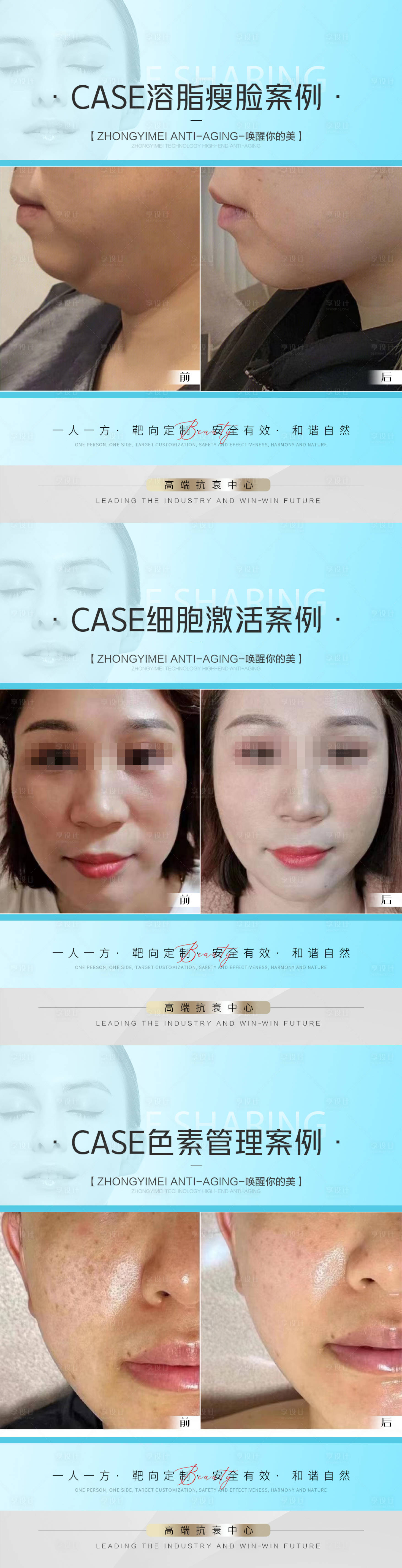 源文件下载【医美抗衰案例对比系列海报】编号：48280014849179965