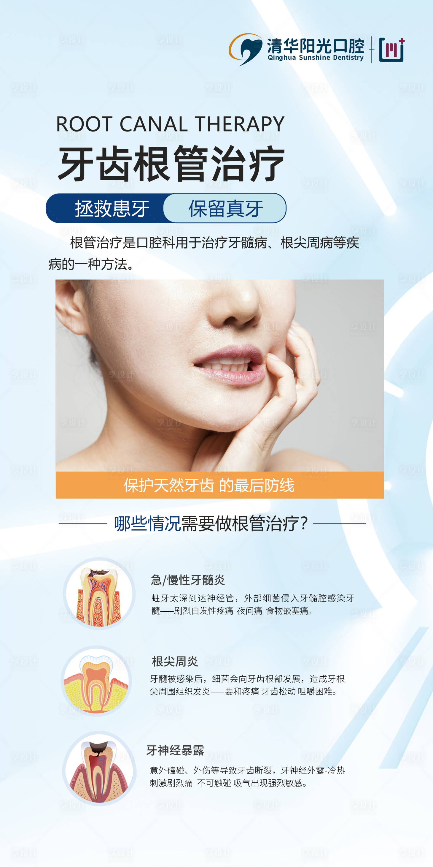 源文件下載【享設計】搜索編號：43830014790941340【根管治療】