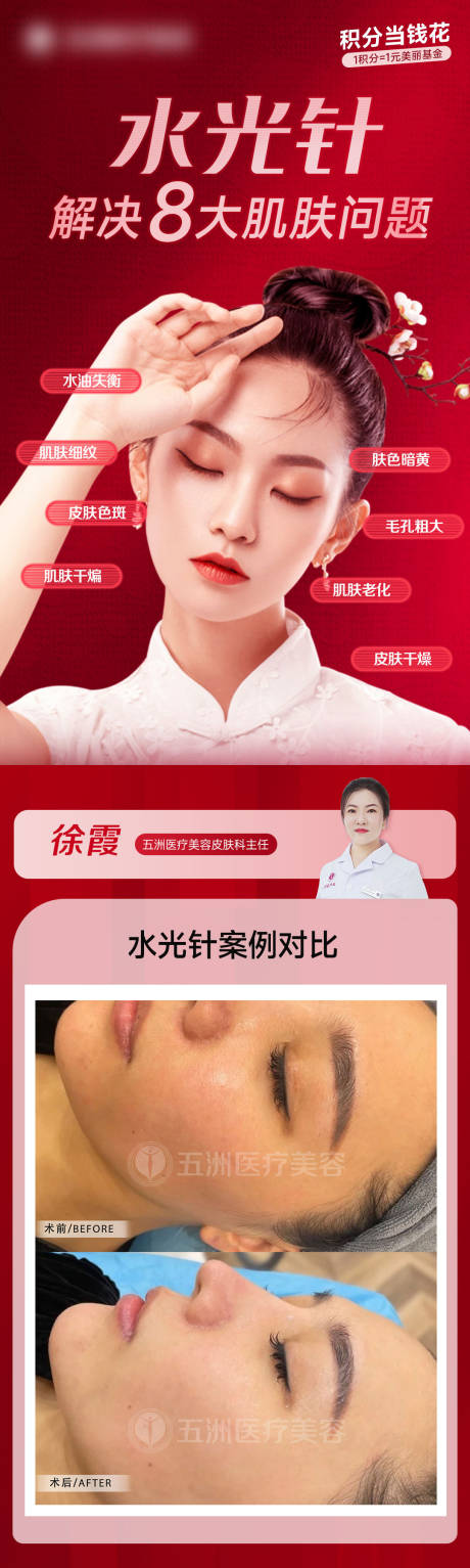 源文件下载【水光针海报】编号：25780014560939492