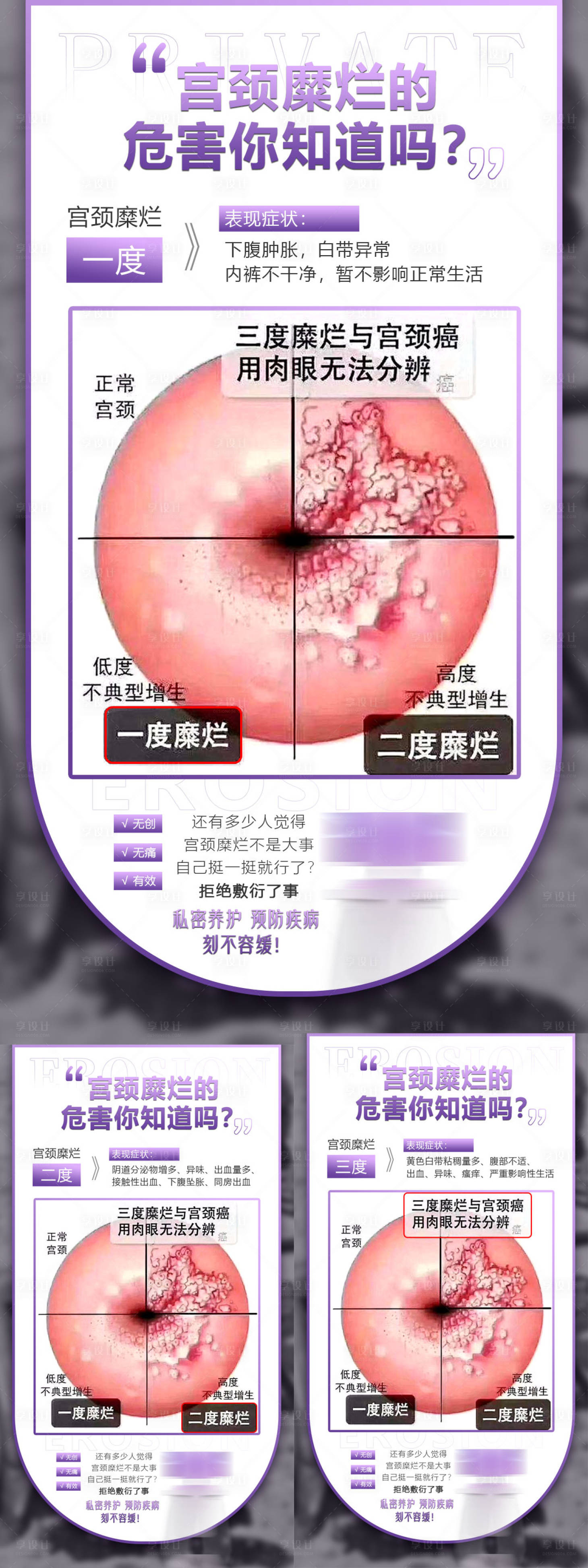 源文件下载【医美私密宫颈糜烂科普系列海报】编号：89030014443837866