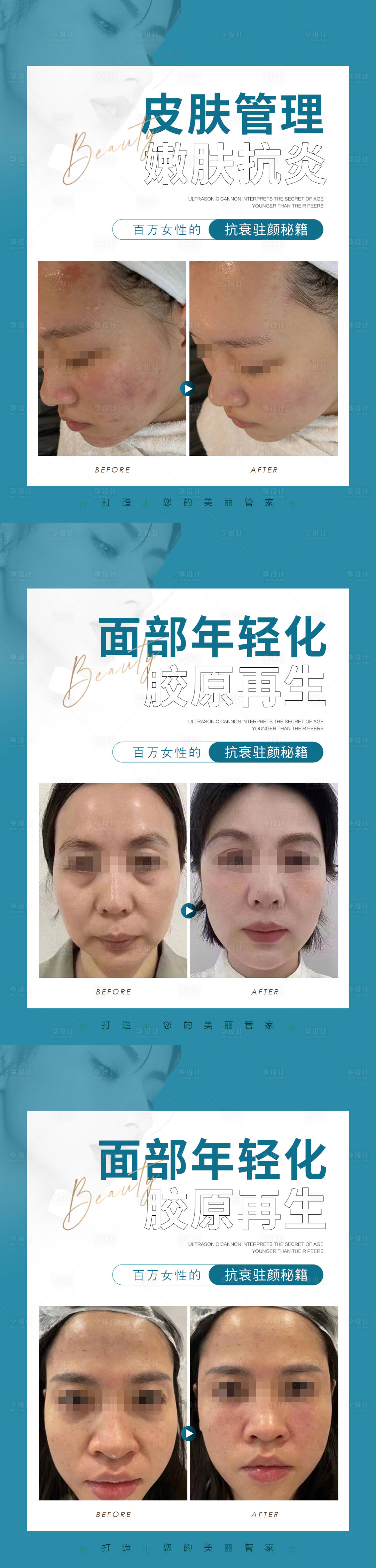 源文件下載【醫(yī)美整形真人案例系列海報】編號：76540014849097107