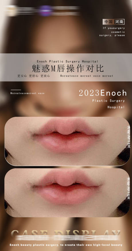 源文件下载【享设计】搜索编号：63350014985579557【医美对比图】