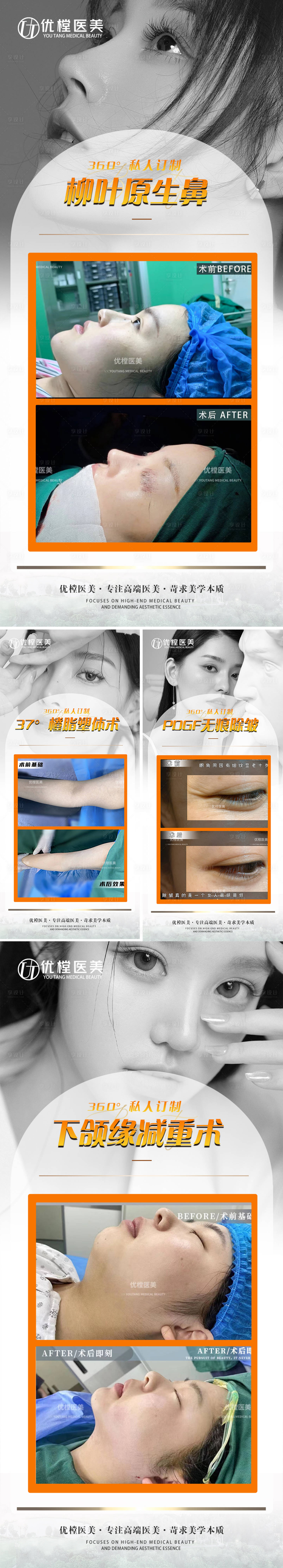 源文件下載【享設(shè)計(jì)】搜索編號(hào)：62110014821985012【醫(yī)美對(duì)比案例海報(bào)】