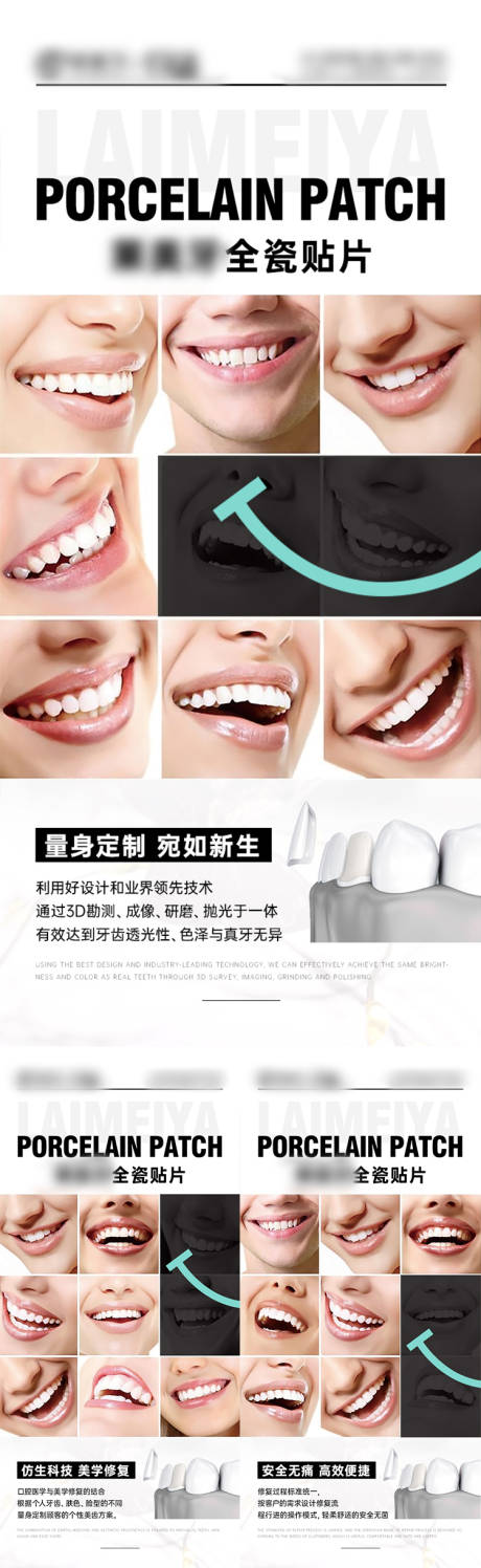 源文件下载【口腔牙齿贴片宣传海报】编号：77000014775223436