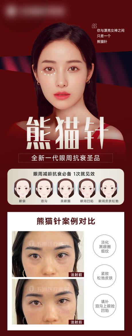 源文件下載【享設計】搜索編號：36670014561832041【醫美熊貓針海報】