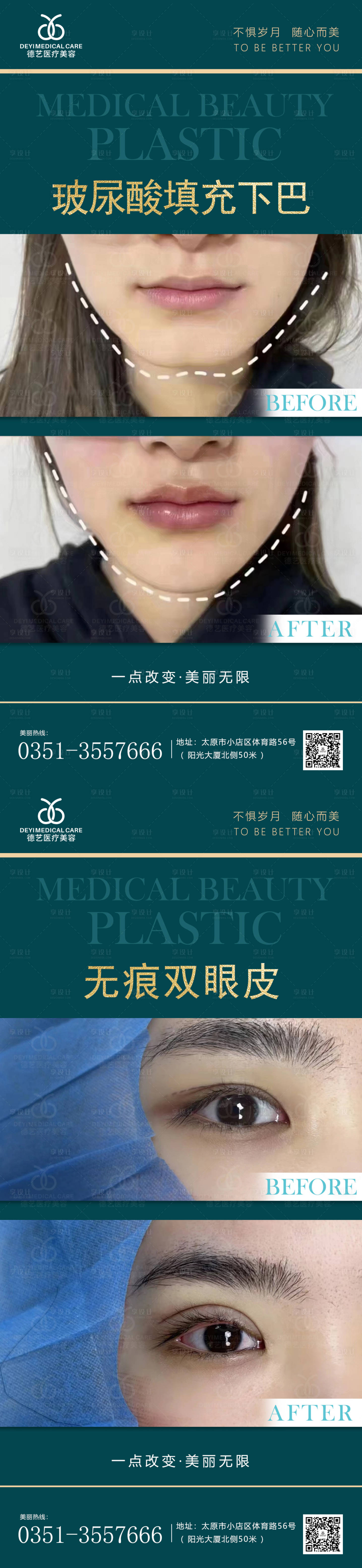 源文件下載【享設計】搜索編號：48490014578793203【醫美案例對比圖】