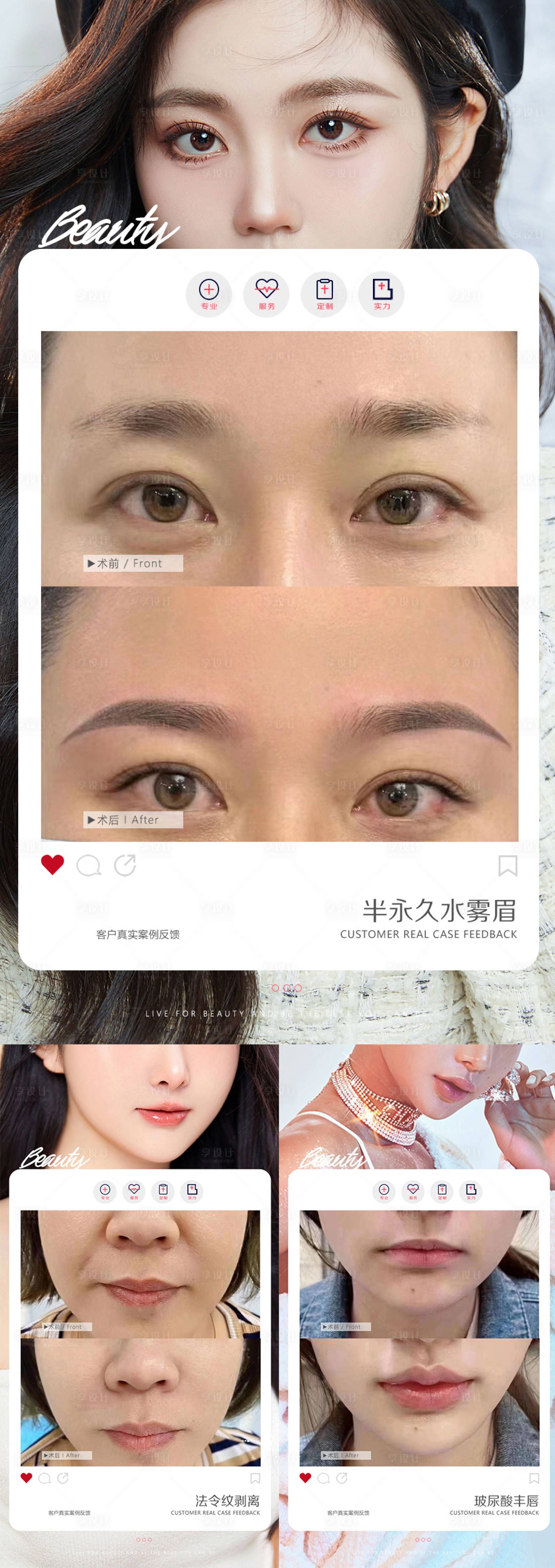 源文件下載【享設計】搜索編號：19090014884019640【醫美法令紋整形前后對比海報】