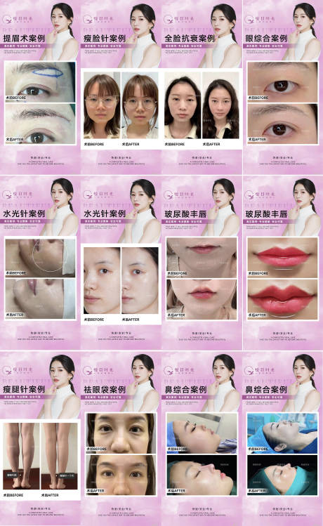 源文件下载【医美整形真人案例对比12组】编号：82100014722874056