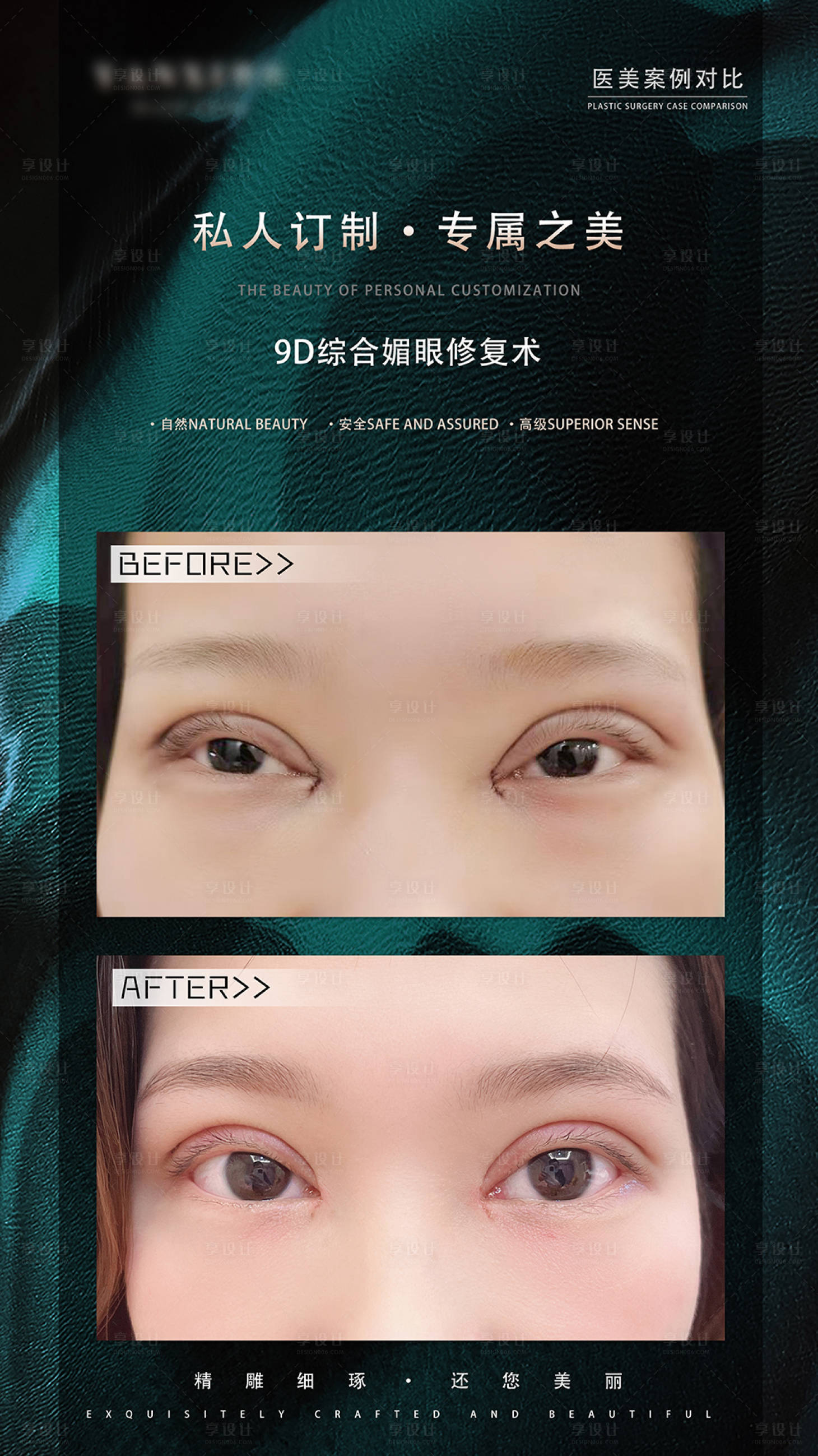 源文件下载【享设计】搜索编号：72520014651324524【眼综合案例对比蓝金海报】