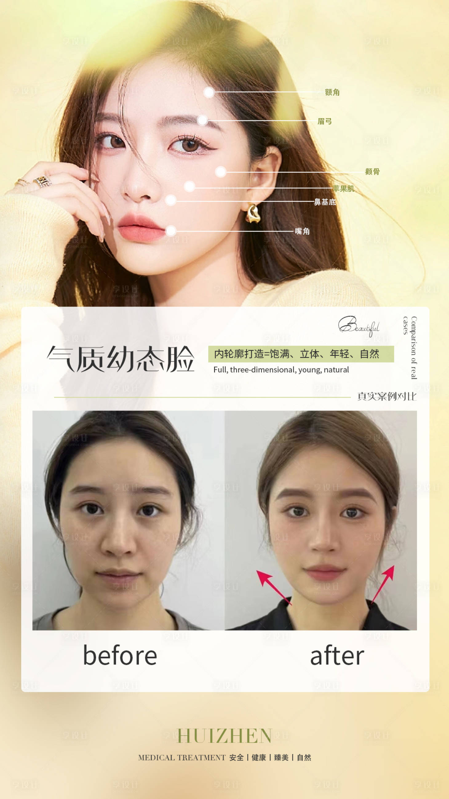 源文件下载【享设计】搜索编号：58140014743161166【医美案例简约海报】