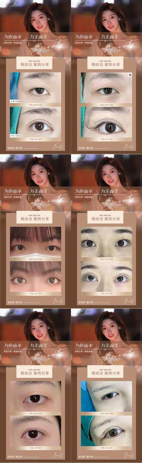 源文件下載【享設計】搜索編號：59270014810008606【醫美眼綜合案例對比系列海報】
