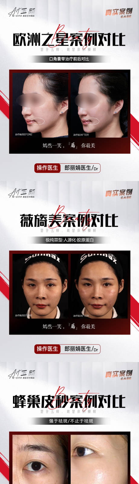 源文件下載【享設(shè)計(jì)】搜索編號(hào)：16710015004861012【醫(yī)美案例】