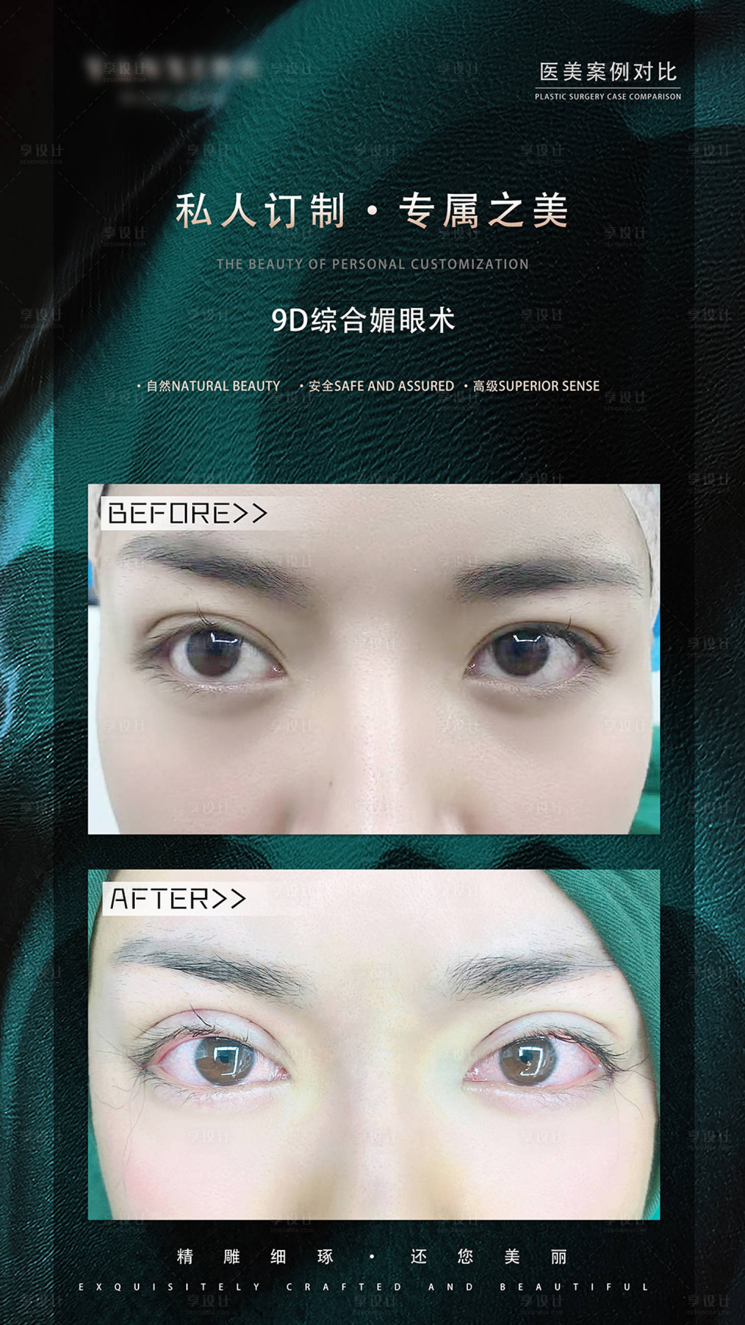 源文件下载【眼综合案例对比简约海报】编号：65790014651125445