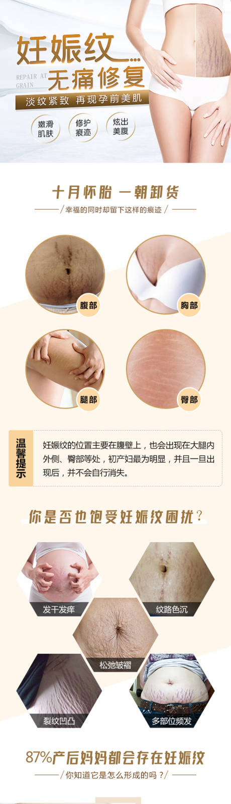 源文件下载【妊娠纹详情页】编号：48680015031451795