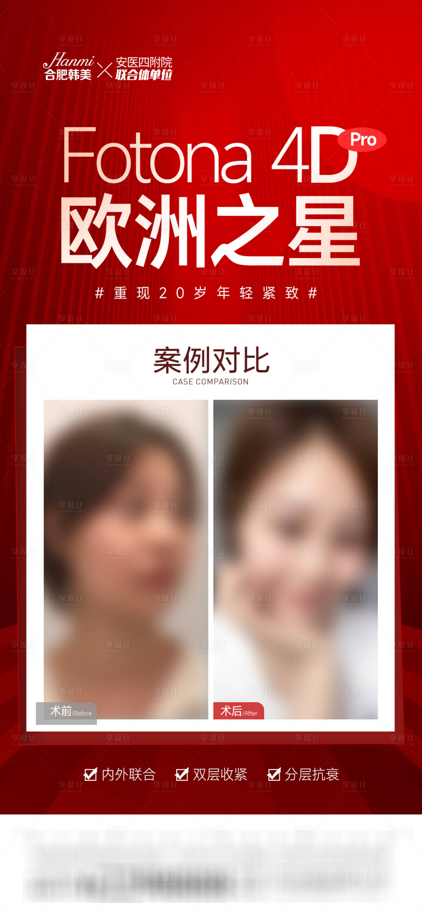源文件下載【享設計】搜索編號：78050014666881332【fotona4D歐洲之星】