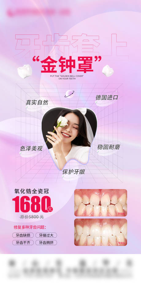 源文件下载【烤瓷牙活动】编号：64150014804254630