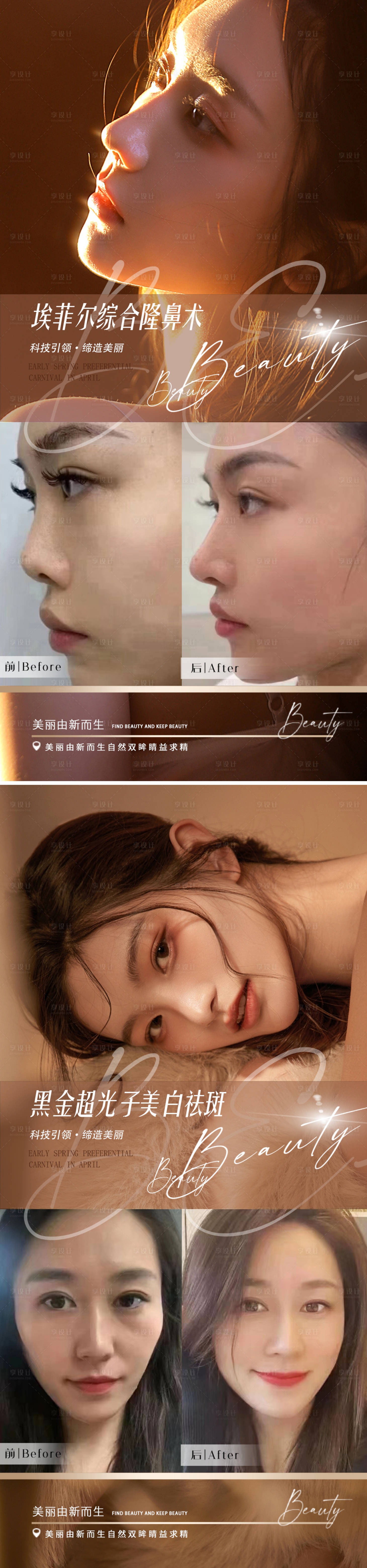 源文件下载【医美隆鼻案例对比海报】编号：53530015040398990