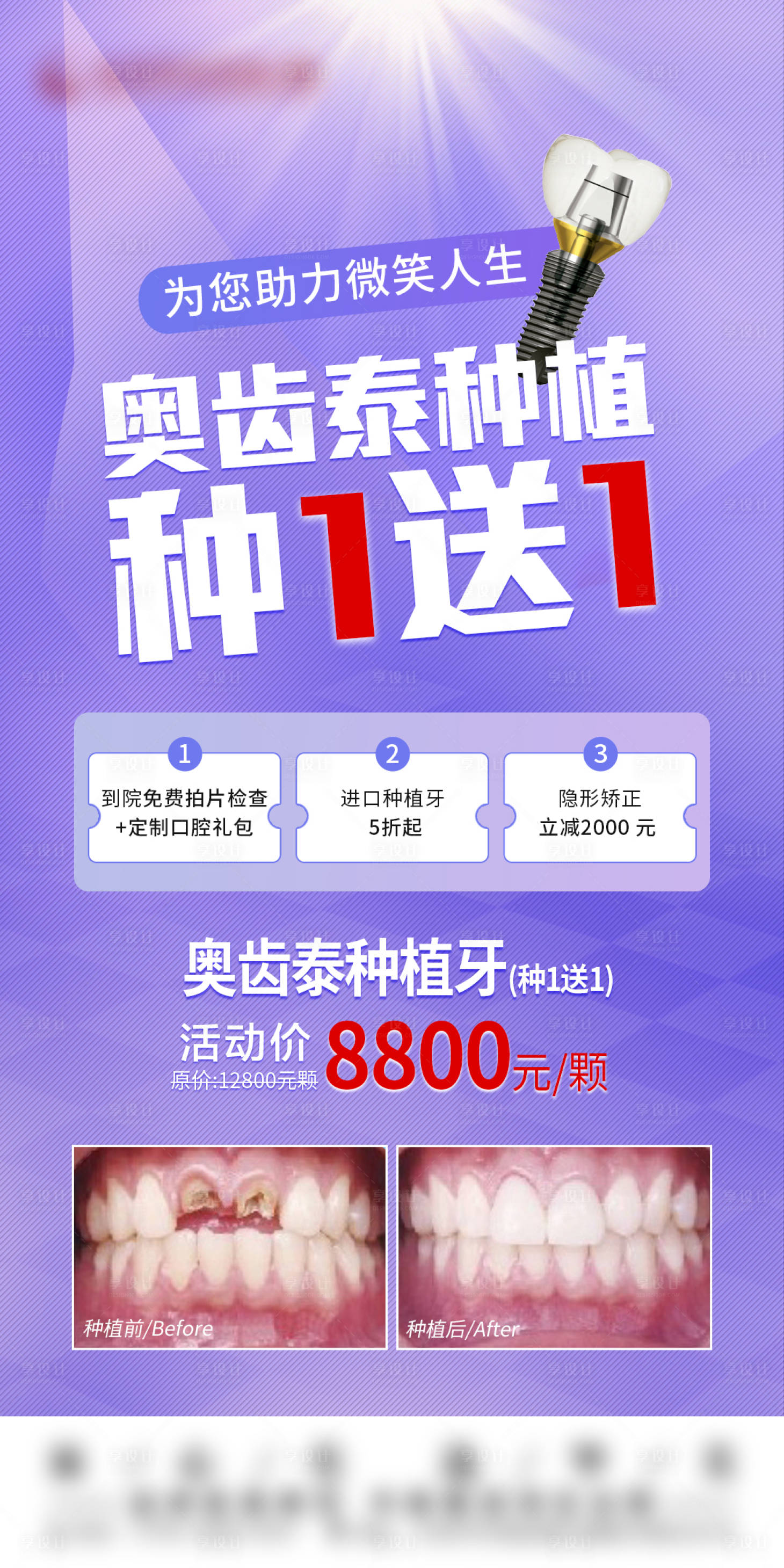 源文件下载【奥齿泰种植简约海报】编号：18410014802432746