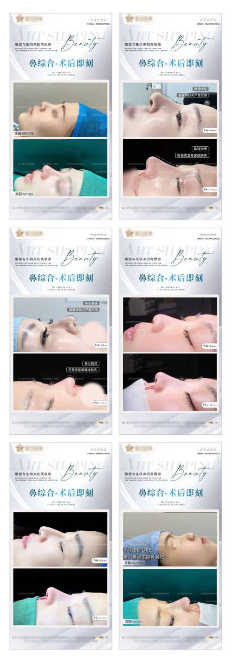 源文件下载【医美鼻综合整形案例海报】编号：11370014661024158