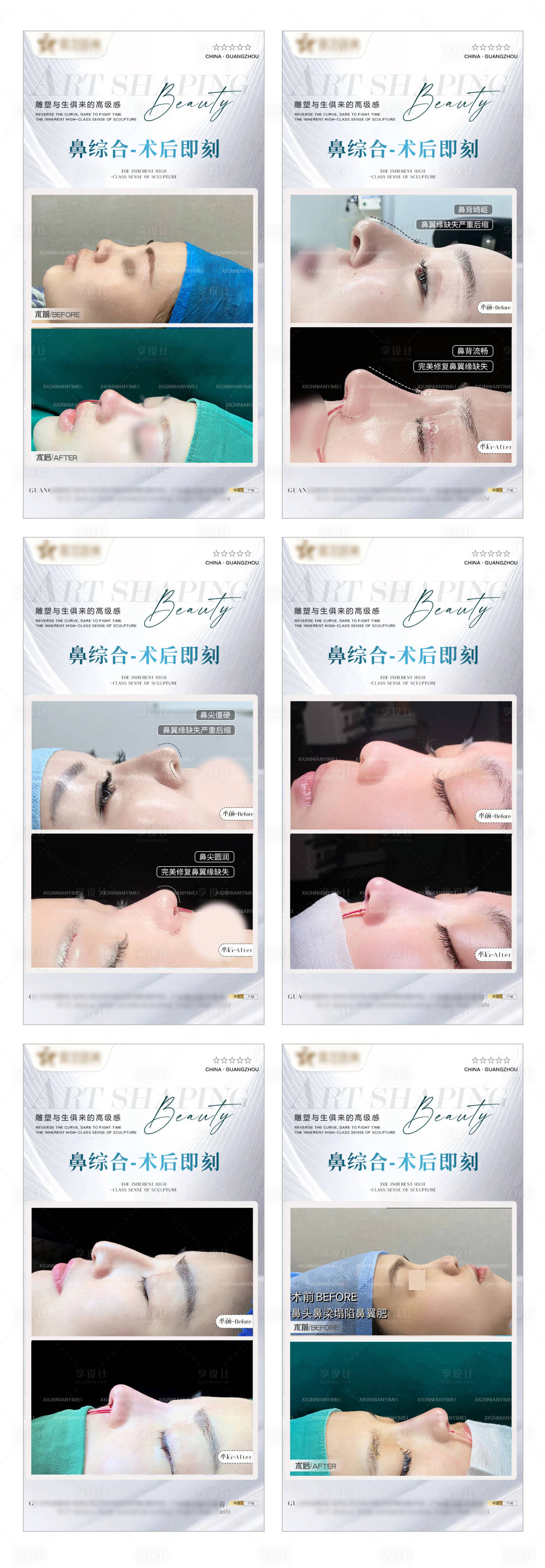 源文件下载【享设计】搜索编号：11370014661024158【医美鼻综合整形案例海报】