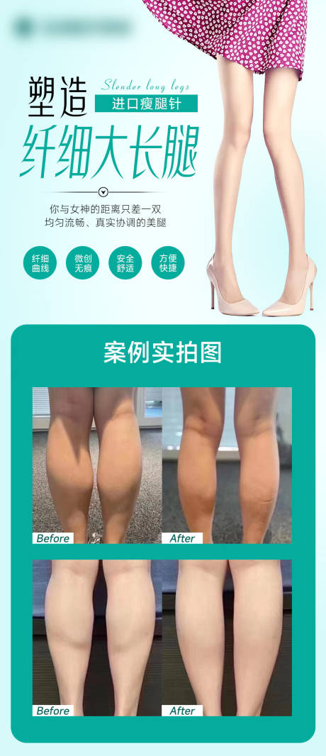 源文件下載【瘦腿針案例海報】編號：91890014560432794