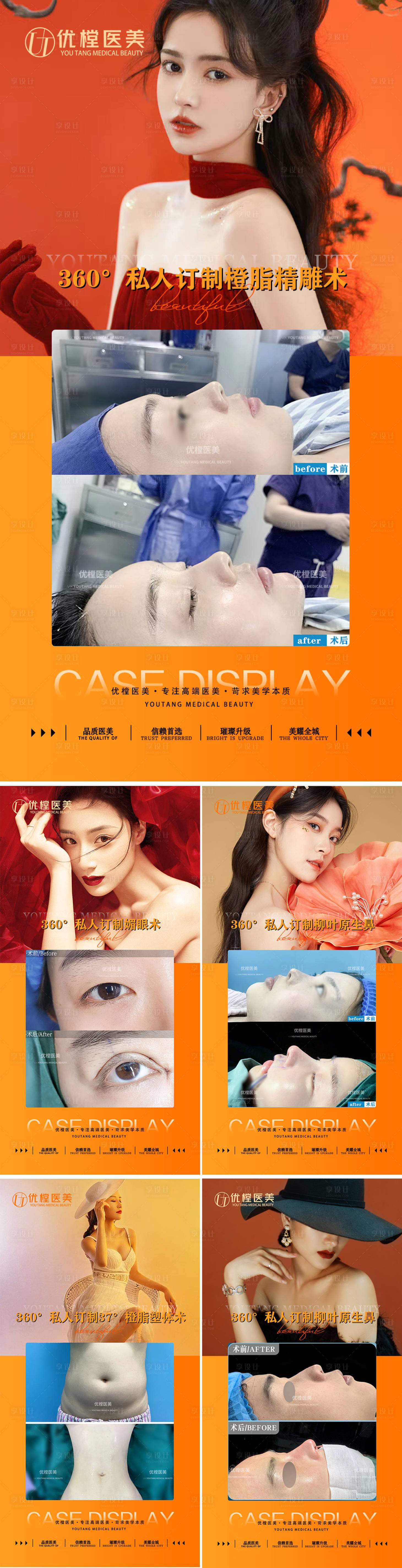 源文件下載【享設計】搜索編號：66210014440521266【醫美案例對比海報 】