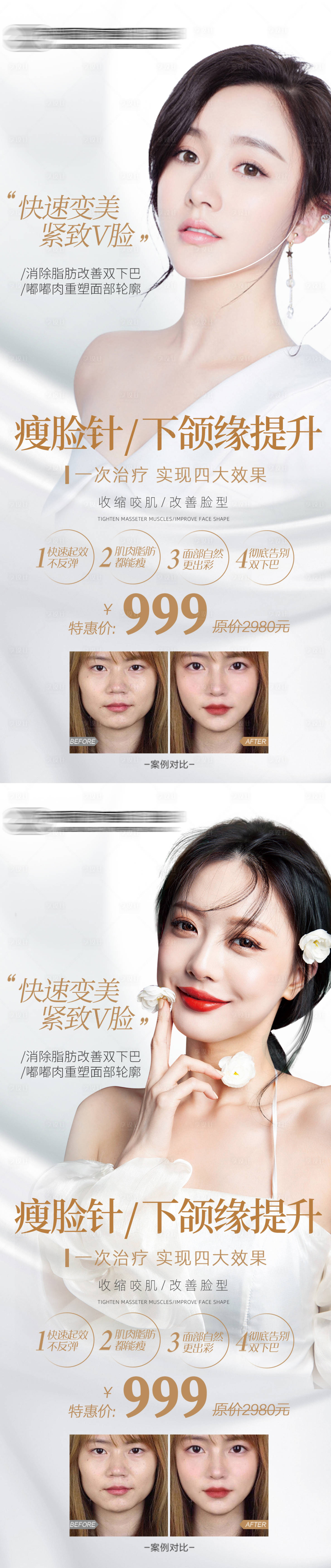 源文件下載【享設(shè)計】搜索編號：18680014829592918【醫(yī)美瘦臉下頜緣項目海報】