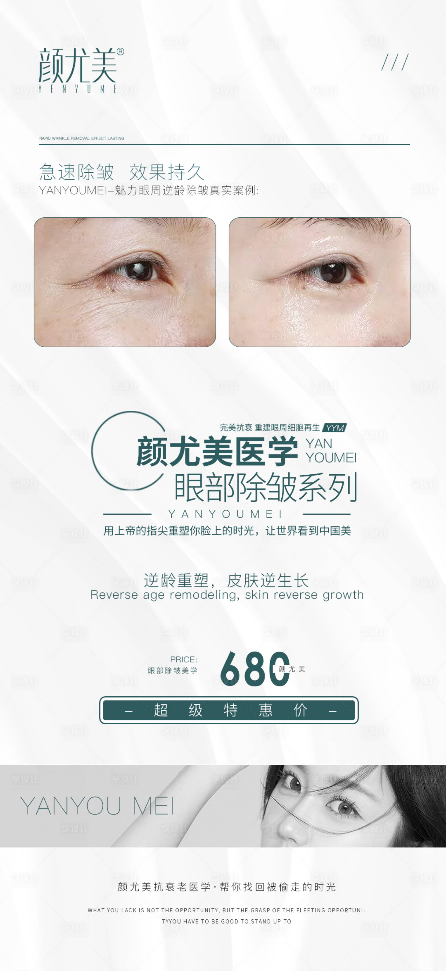 源文件下载【医美眼部除皱促销海报】编号：87180014765321121
