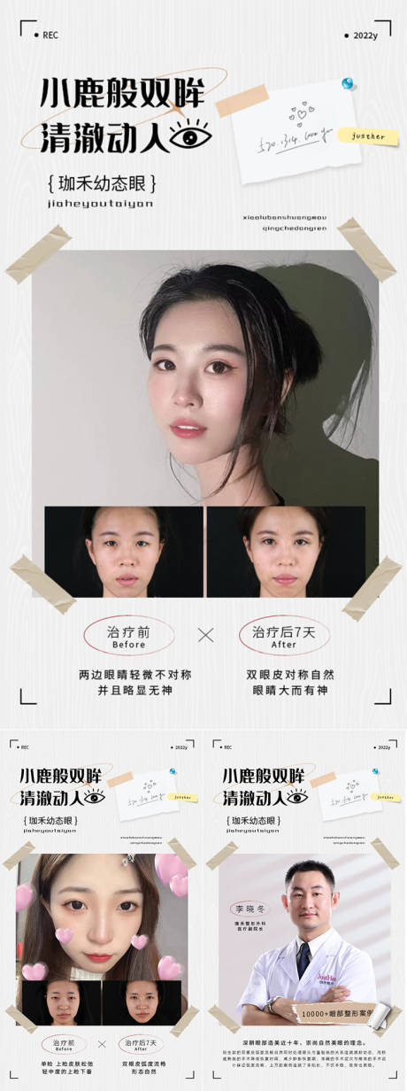 源文件下载【医美案例海报】编号：91040014428618610