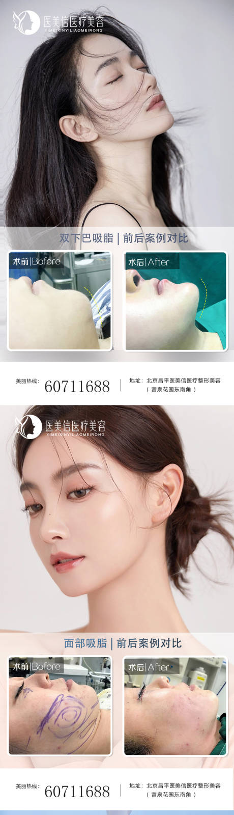 源文件下载【医美吸脂案例海报】编号：55250014779485015