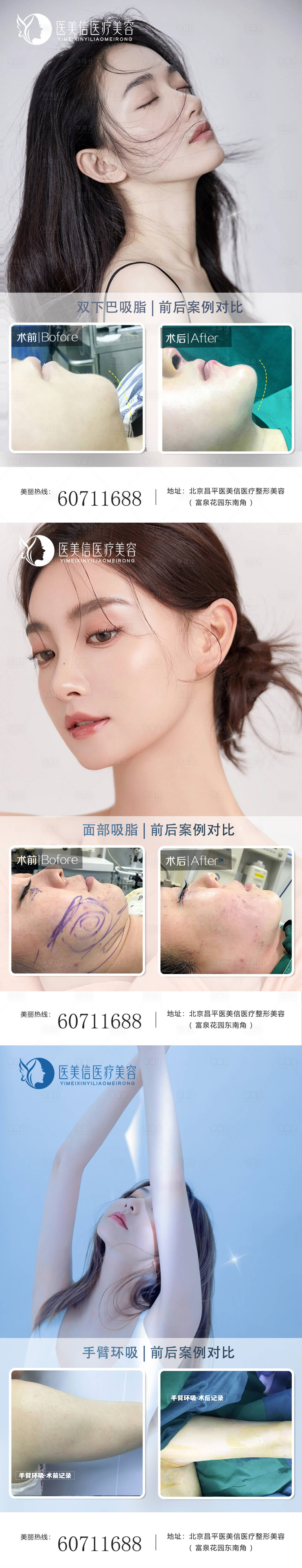 源文件下載【享設計】搜索編號：55250014779485015【醫美吸脂案例海報】