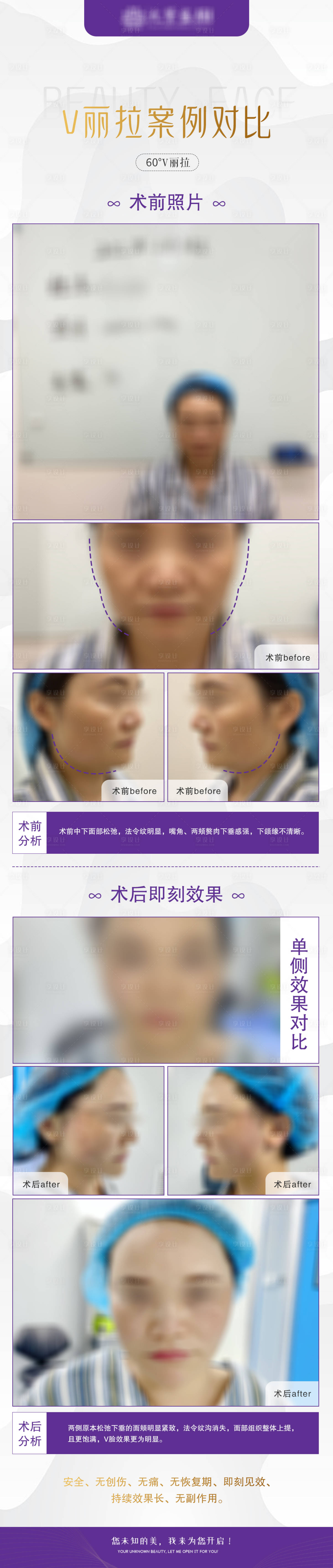 源文件下载【医美案例对比海报长图】编号：63440014908709474