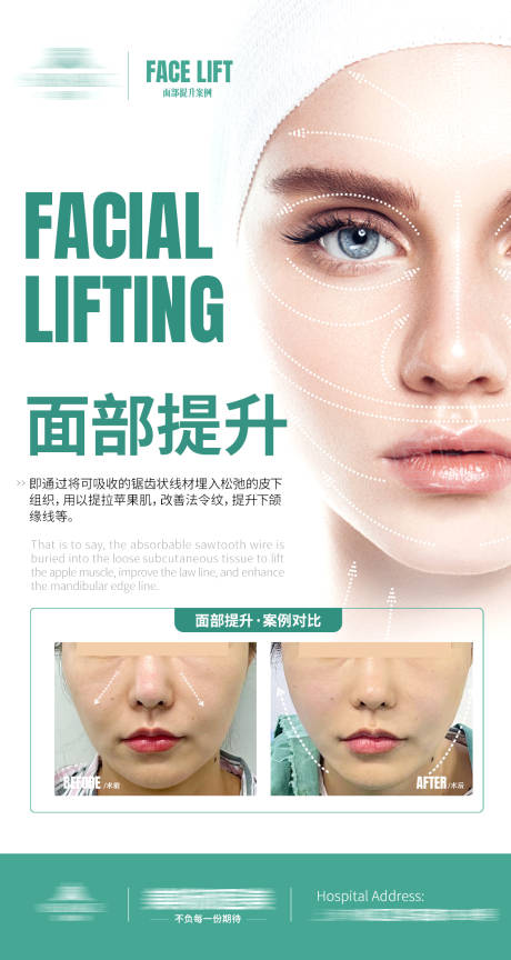 源文件下载【医美整形案例海报】编号：20900014596057360