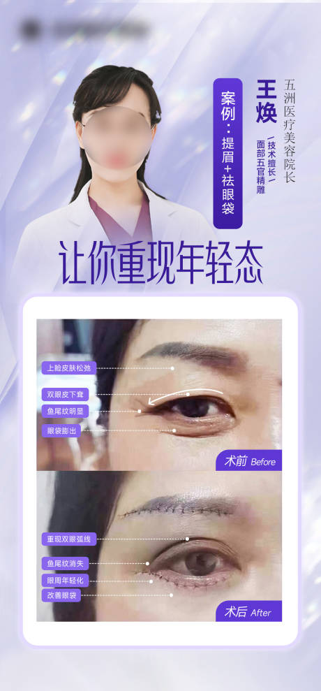 源文件下载【提眉祛眼袋海报（TIF用PS打开）】编号：33880014561134054
