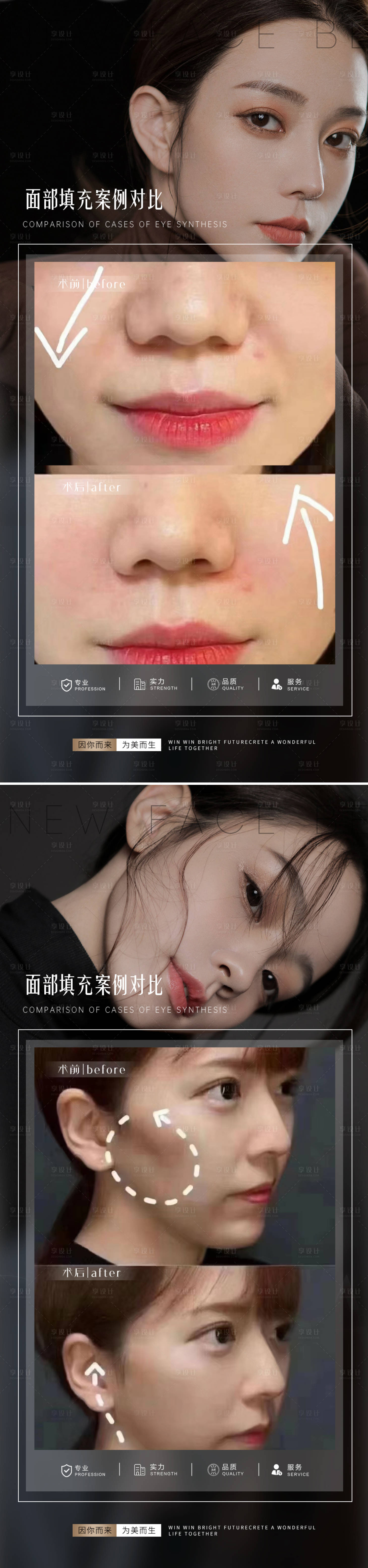 源文件下载【医美抗衰案例对比海报】编号：63920014758818732