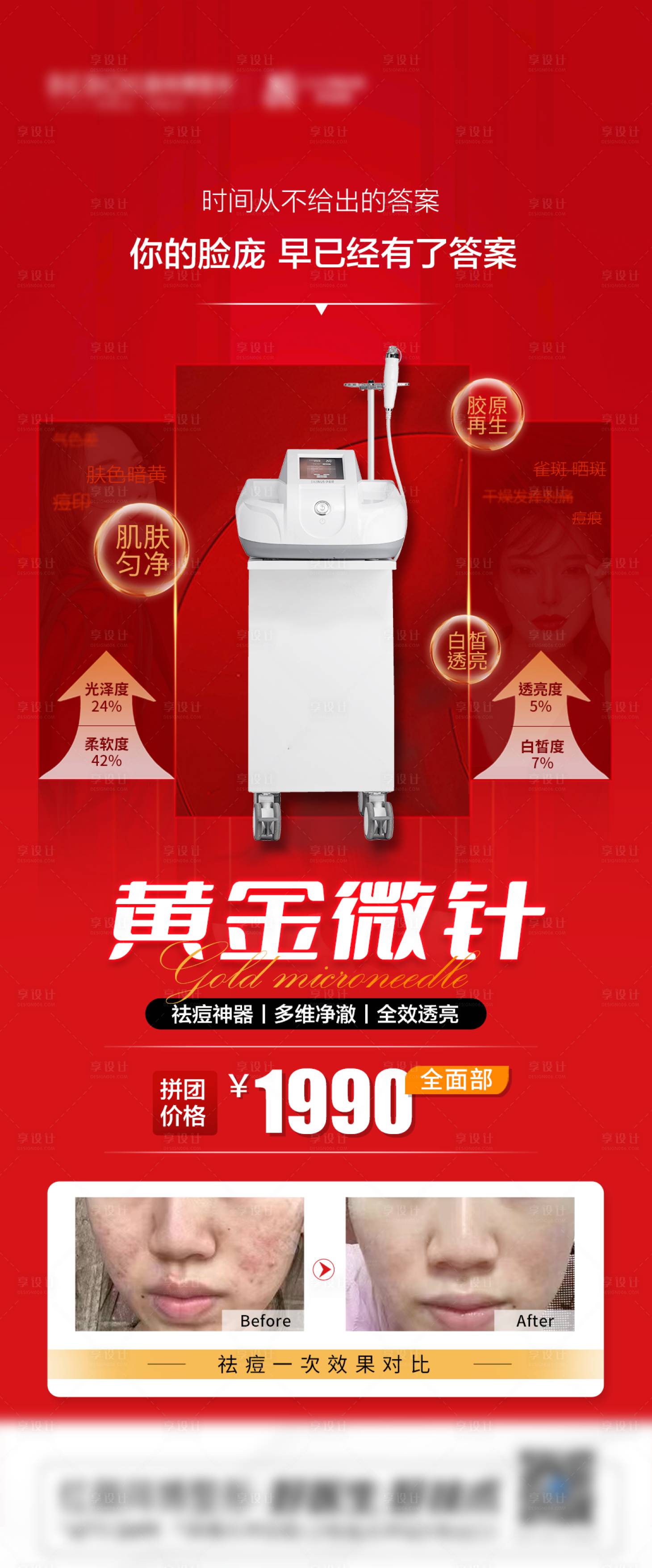 源文件下載【享設計】搜索編號：90800014885837064【醫美黃金微針儀器紅色海報】