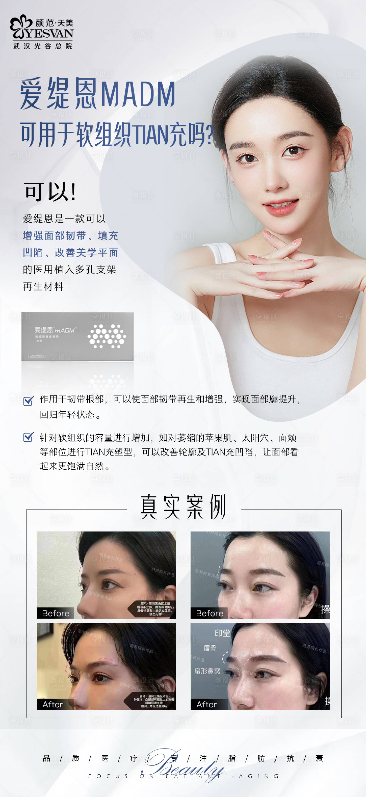 源文件下載【享設計】搜索編號：52220014654018482【愛緹恩項目宣傳海報】